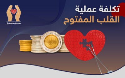 تكلفة عملية القلب المفتوح.. تعرف على كافة التفاصيل