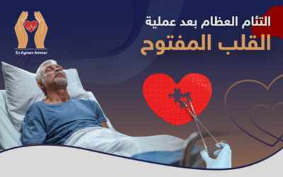فترة التئام العظام بعد عملية القلب المفتوح