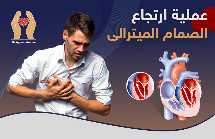 عملية ارتجاع الصمام الميترالي