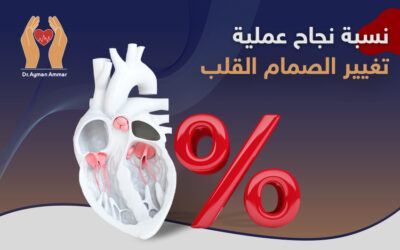 نسبة نجاح عملية تغيير صمام القلب